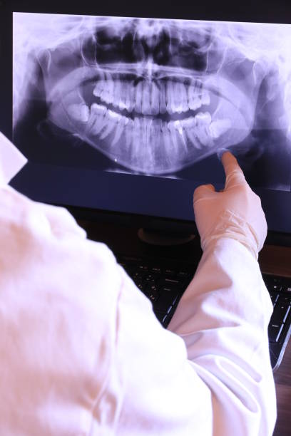Best Emergency Treatment for Dental Infections or Abscesses in West Mifflin, PA