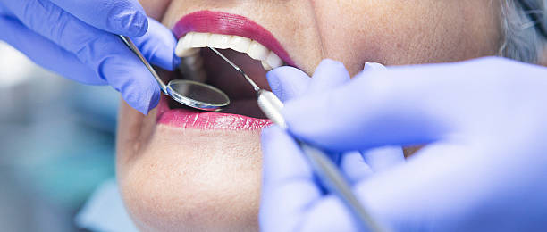 Best Emergency Dental Care for Broken or Chipped Teeth in West Mifflin, PA